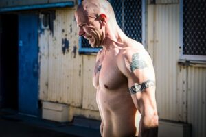 多汗症のミラドライ治療を比較して、自分に合った選択を見つけるには？