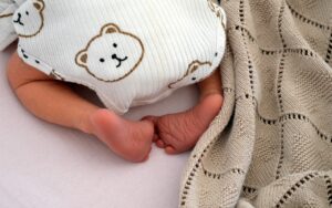 多汗症の手術後に再発する可能性は？